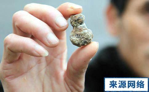 肾结石吃角瓜,角瓜助力健康排石新选择 第3张 肾结石吃角瓜,角瓜助力健康排石新选择 第3张